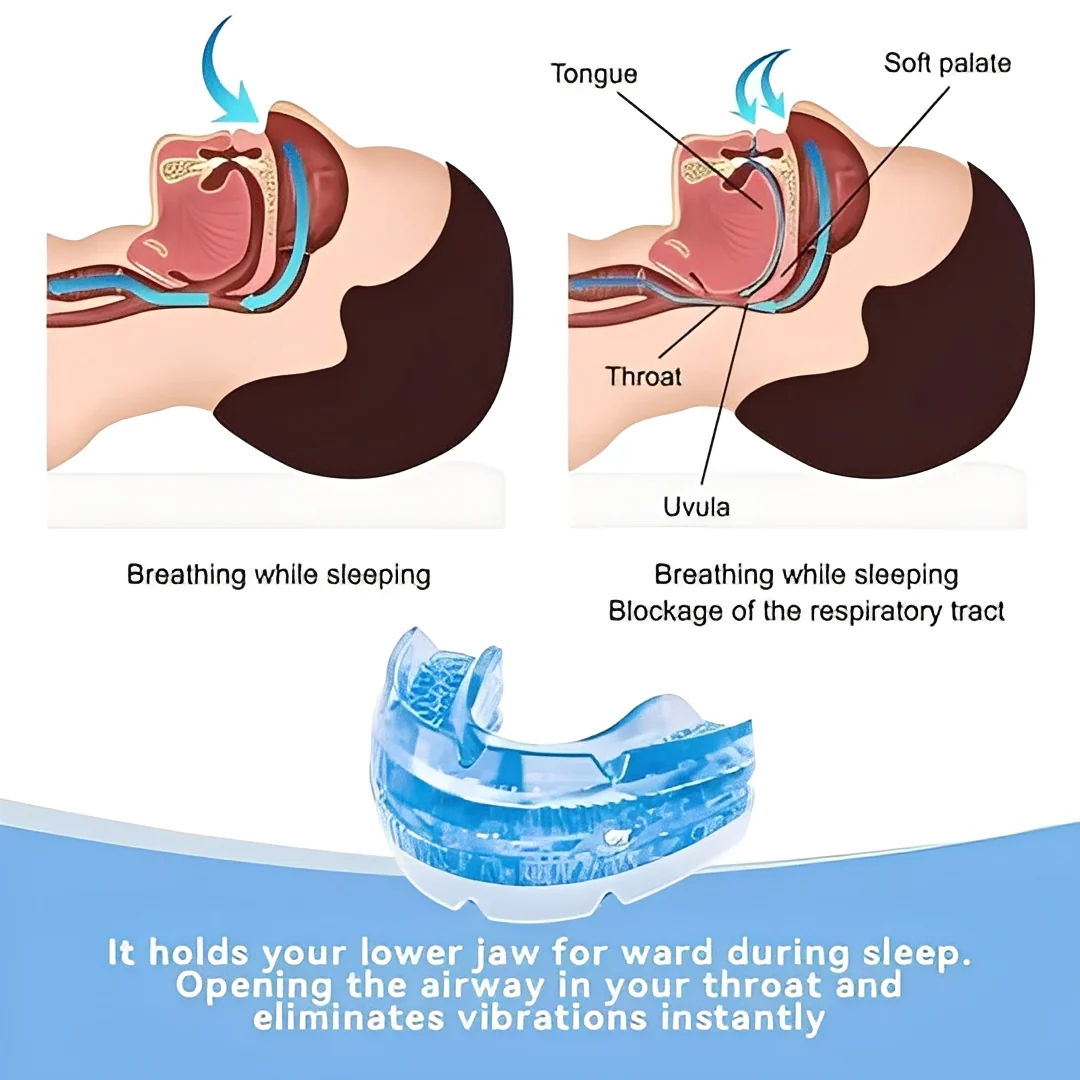 Adjustable Moldable Mouthpiece with Screw Based Fit for Nighttime Use - Image 4