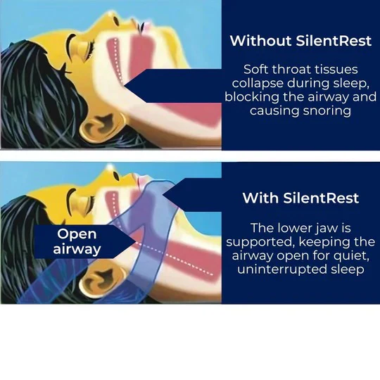 Chin Strap for Snoring and Sleep Support - Image 7