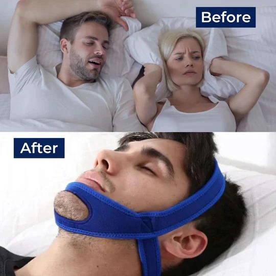 Chin Strap for Snoring and Sleep Support - Image 8