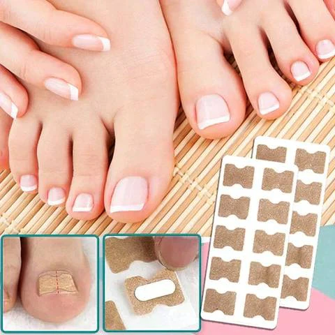 Ingrown Nail Correction Tool with Instant Repair Treatment - Image 2