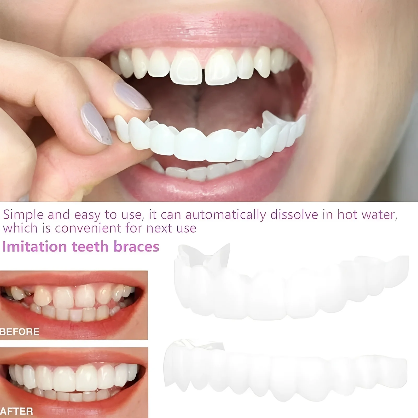 Snap On Cosmetic Tooth Covers for Adults, 2 Piece Set - Image 4