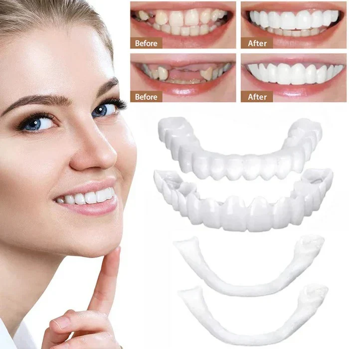 Clip On Cosmetic Veneers and Temporary Tooth Covers - Image 5