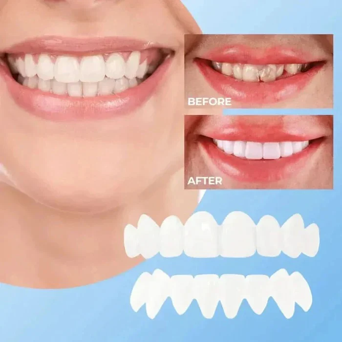 Clip On Cosmetic Veneers and Temporary Tooth Covers - Image 6