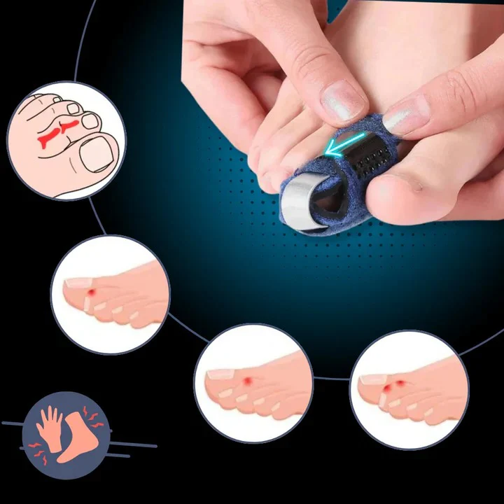 Toe Positioning Support with Breathable Design - Image 4