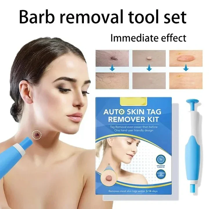 Skin Tag Removal Kit with Silicone Bands & Pen Band Tool - Image 3