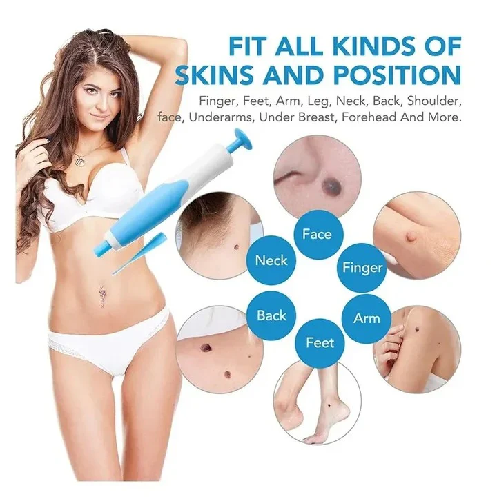 Skin Tag Removal Kit with Silicone Bands & Pen Band Tool - Image 4