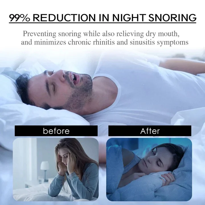 Sleep Mouth Tape for Nasal Breathing Support - Image 3