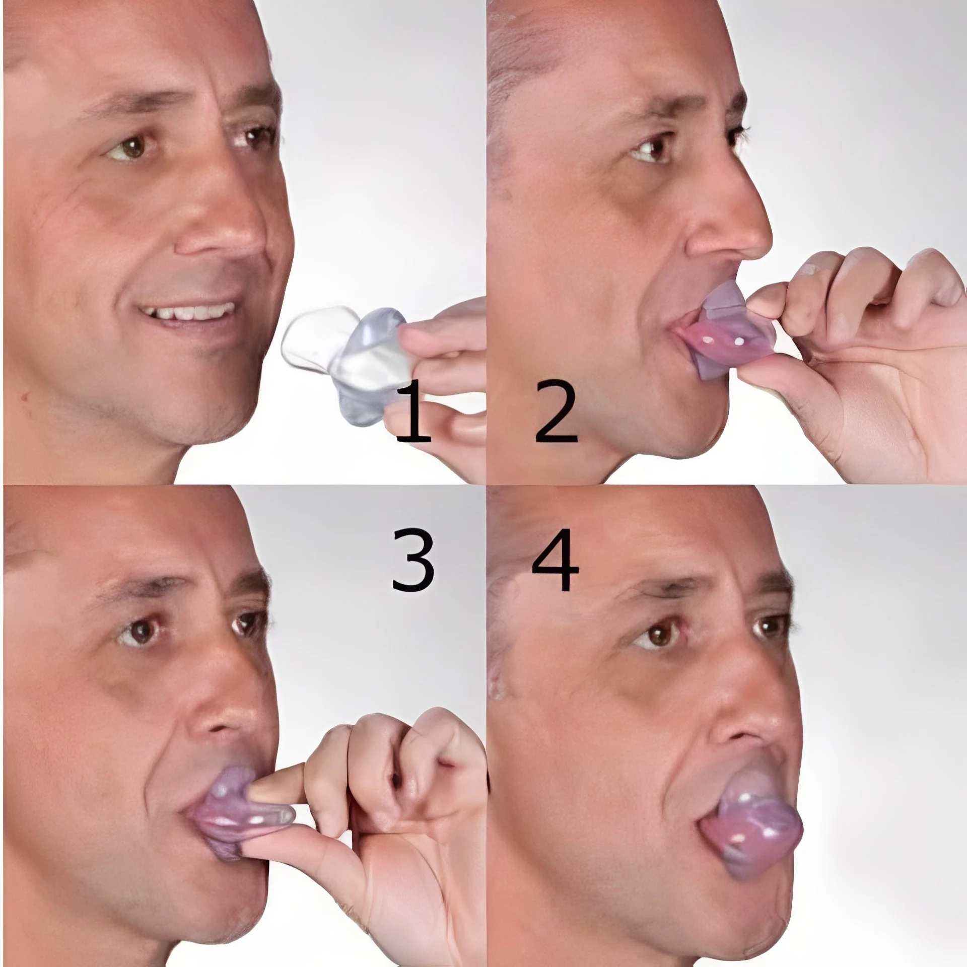 Tongue Positioning Device for Sleep Airflow Support - Image 6