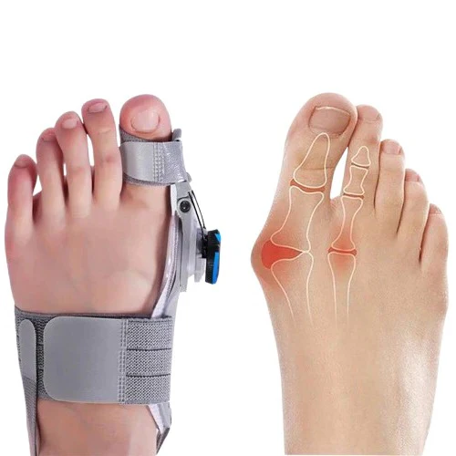 Adjustable Toe Spacer for Foot Alignment Support - Image 3