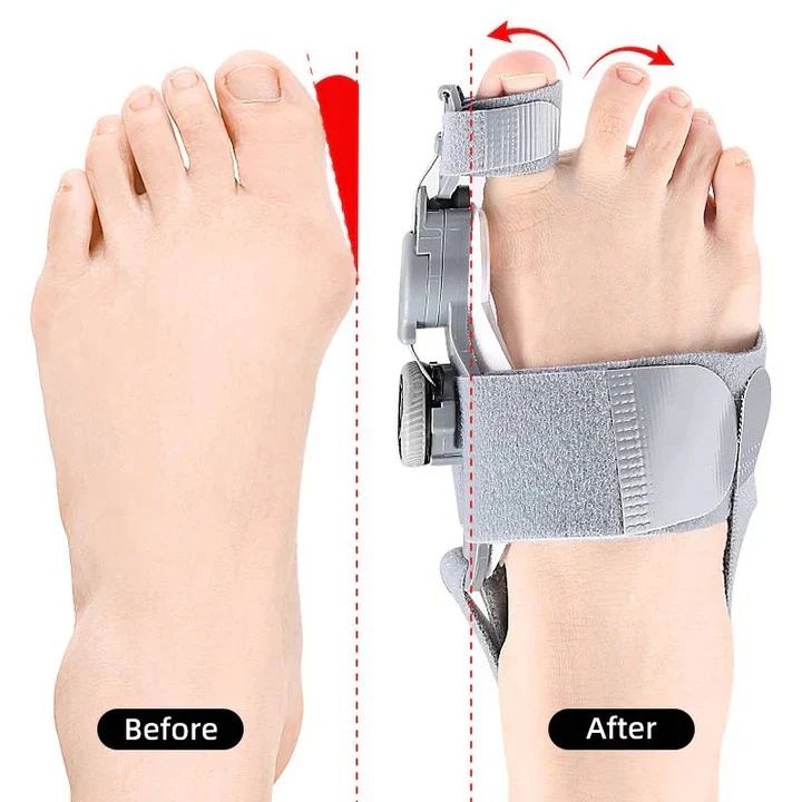Adjustable Toe Spacer for Foot Alignment Support - Image 6