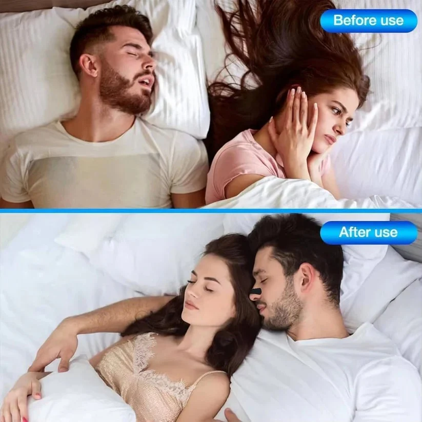 Triple Layer Nasal Strips for Nighttime Breathing Support - Image 9